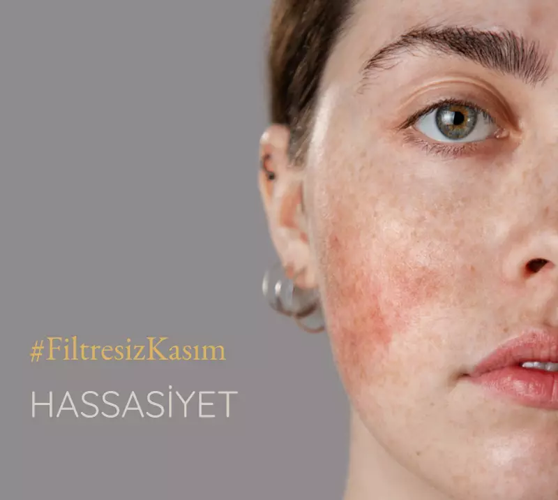 filtresiz kasım, hassas cltler